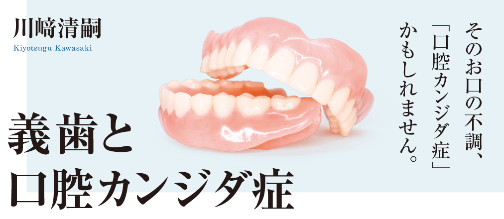 義歯と口腔カンジダ症 川﨑清嗣
